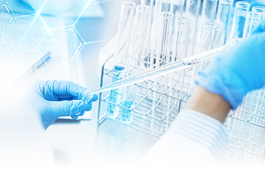 Cholesterol Esterase (CHE-XE)