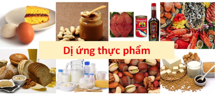 dị ứng thực phẩm
